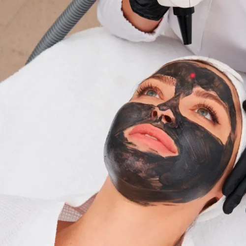 Kosmetikbehandlungen, Carbonlaserpeeling von Relax plus Wellness Lounge aus Leipzig